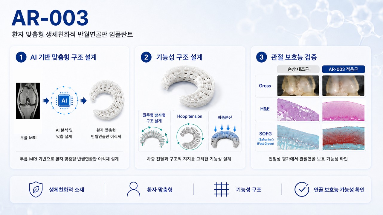 AR-003 — AI 기반 맞춤형 구조 설계, 기능성 구조 설계, 관절 보호능 검증의 3단계